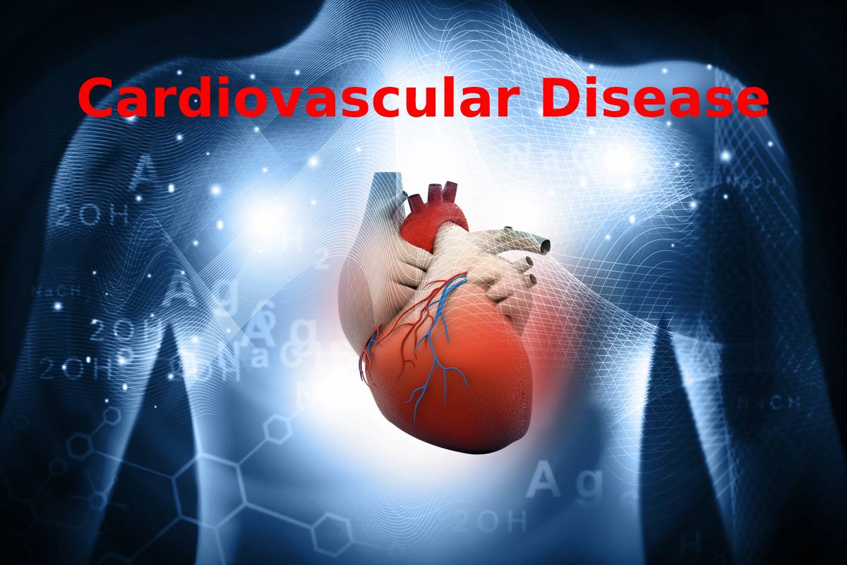 Cardiovascular Disease or Illnesses Facts, Risk Factors, Symptoms 2022