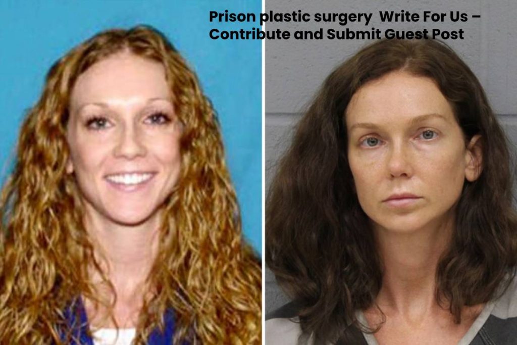 Prison plastic surgery