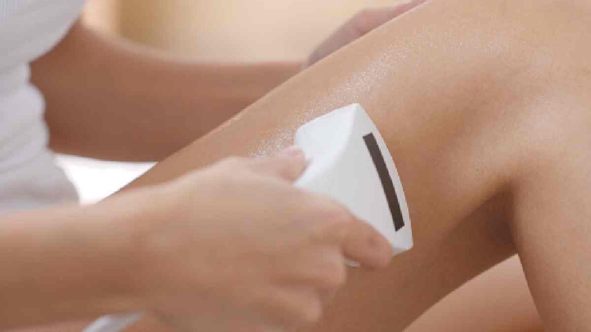 The Pros and Cons of Laser Hair Removal for Hands