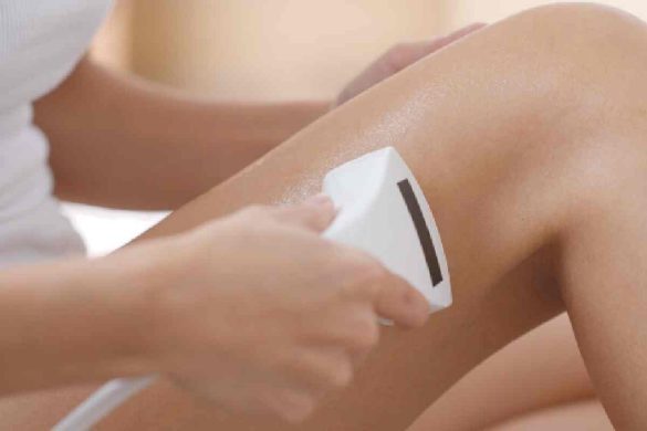 The Pros and Cons of Laser Hair Removal for Hands