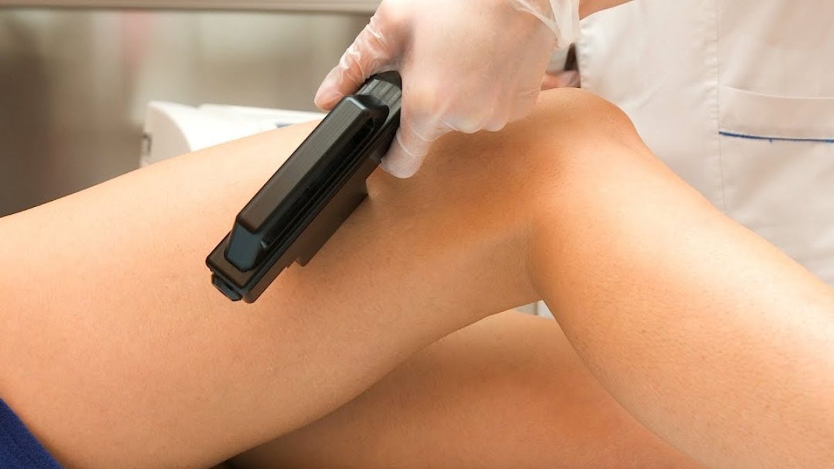 The Pros and Cons of Laser Hair Removal for Hands