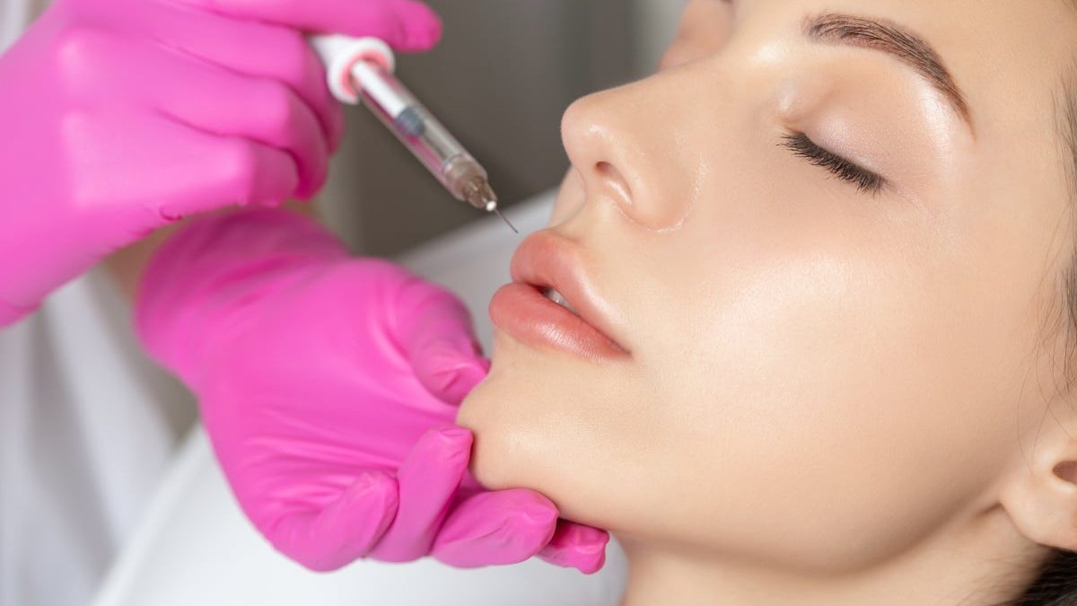 What Is a Lip Flip with Botox?