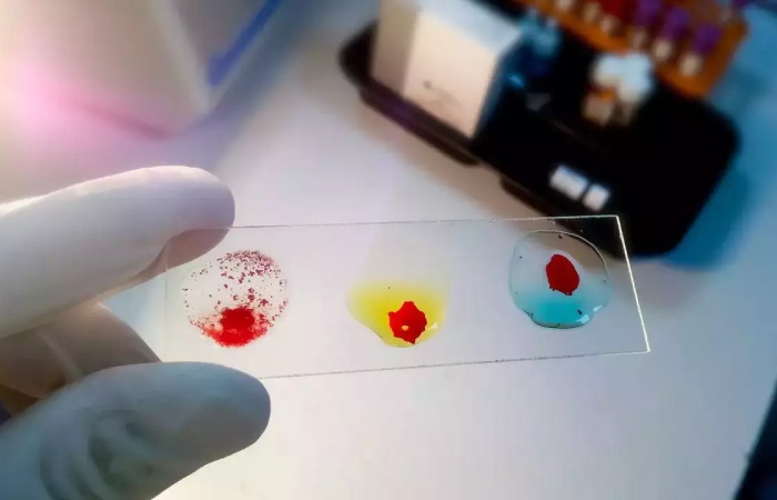Rajkotupdates.News_EMM-Negative-Rare-Blood-Group-Found-In-Rajkot-Man-11th-Such-Case-Worldwide (2)