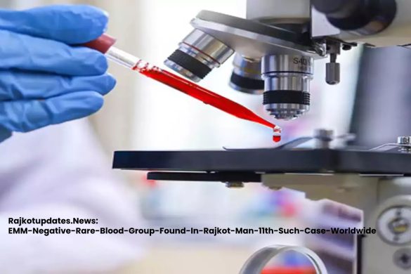 Rajkotupdates.News_EMM-Negative-Rare-Blood-Group-Found-In-Rajkot-Man-11th-Such-Case-Worldwide