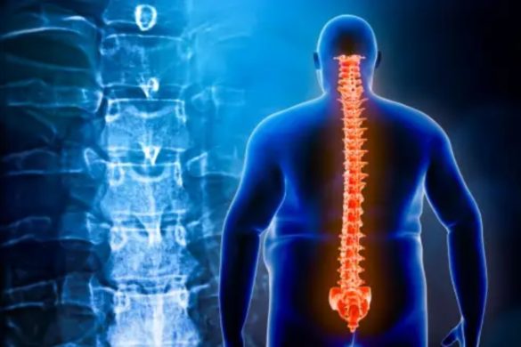 https___www.agresi.my.id_2021_10_back-pain-management-and-pain-relieving.html (6)
