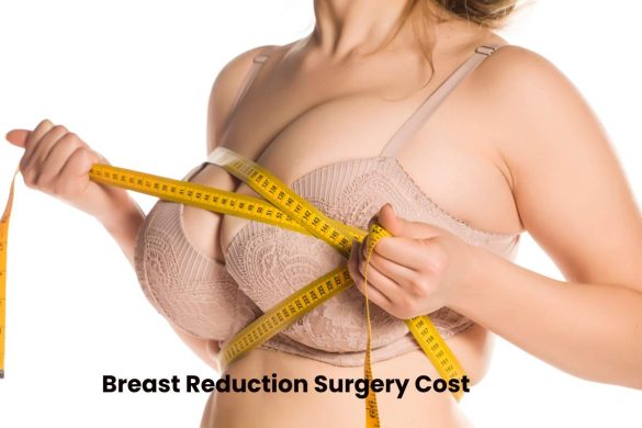 breast reduction surgery cost (1)