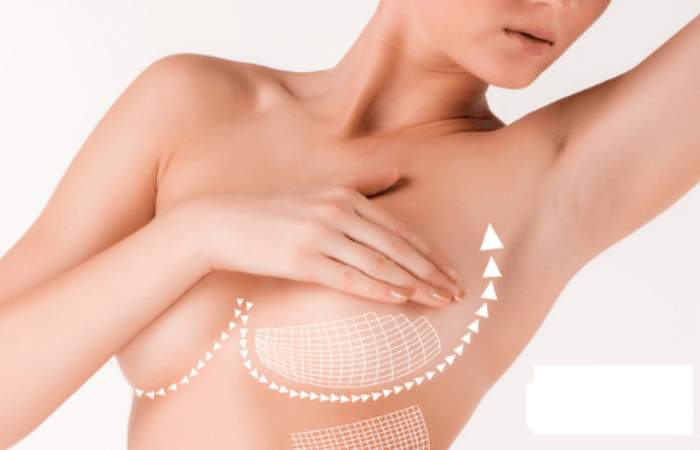 breast reduction surgery cost (3)