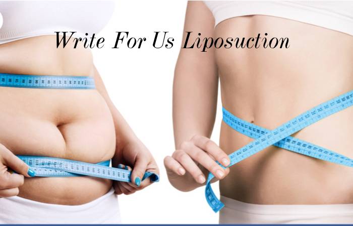 Write For Us Liposuction