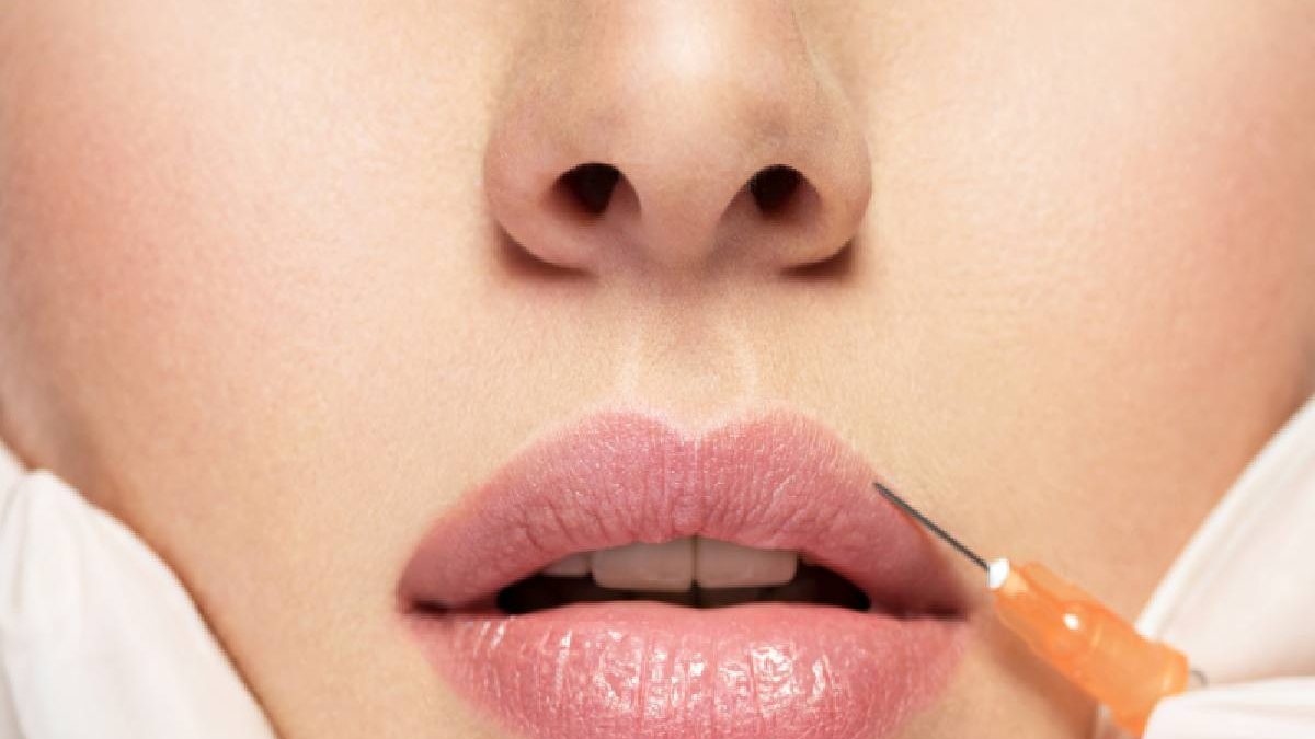 What Is a Lip Flip with Botox?
