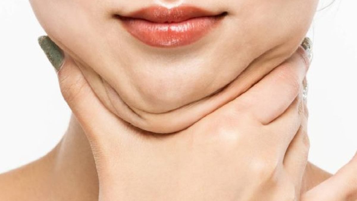 5 Best Exercises to Get Rid of A Double Chin
