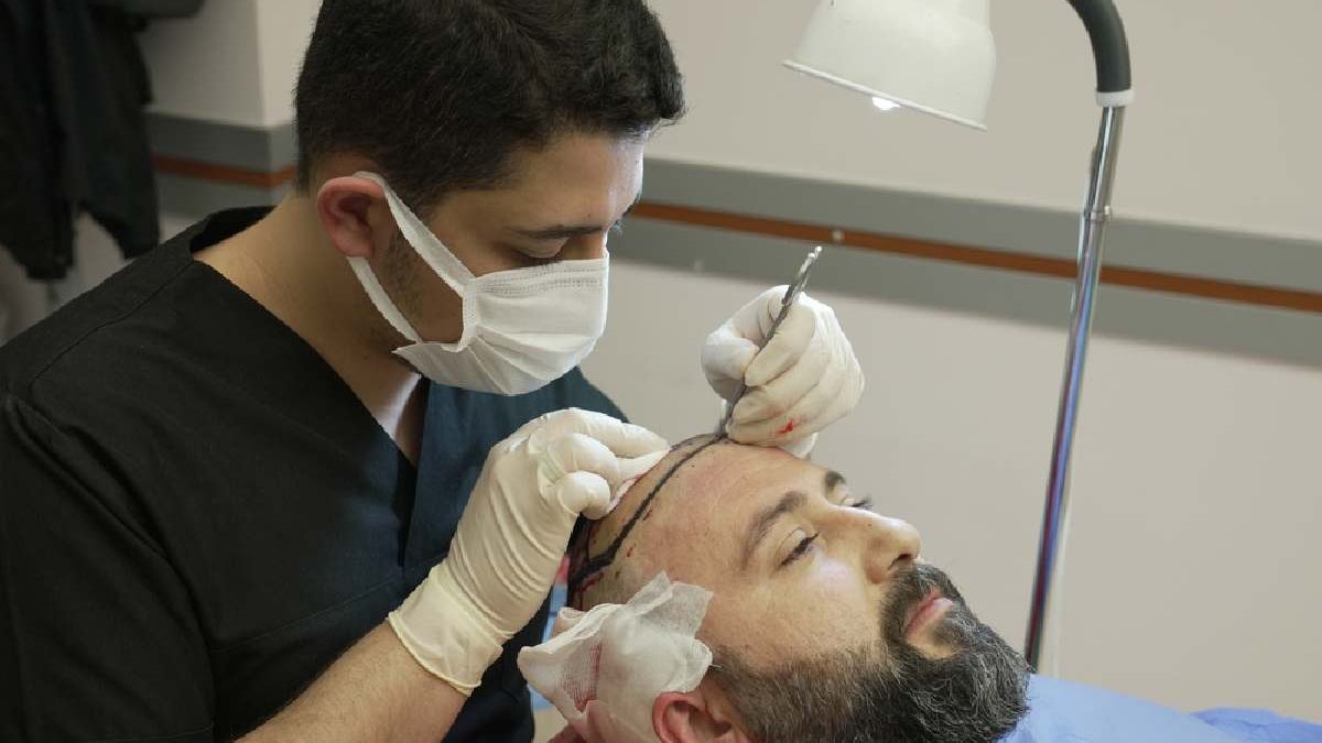 Hair transplant in Turkey – Cosmedica Clinic